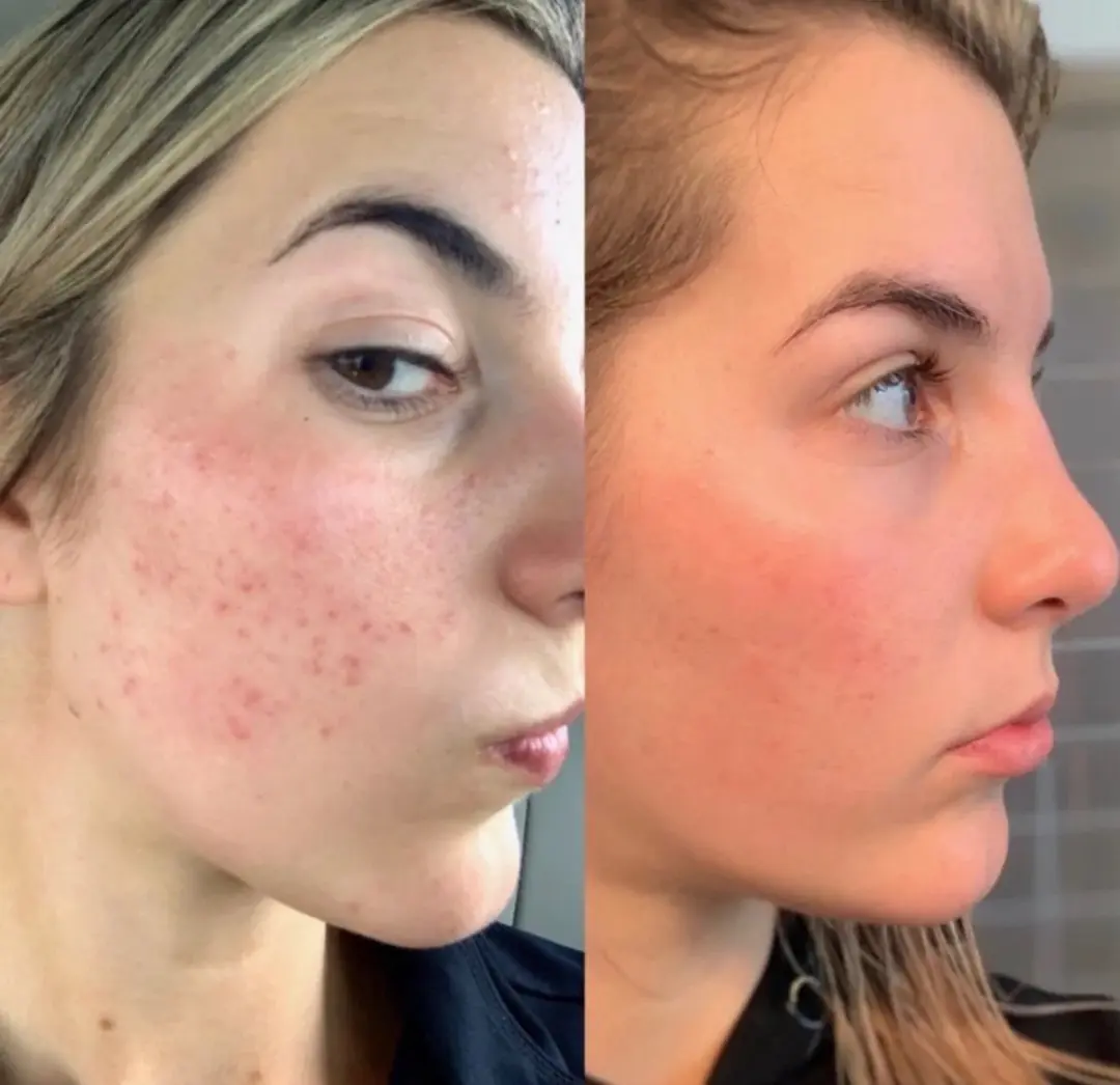 The Ordinary Retinol 0.2% in Squalane Serum 30ml