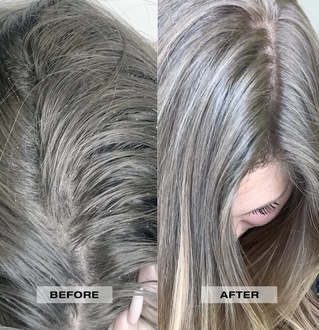 L'anza Scalp Therapy Balancing Conditioner 250ml