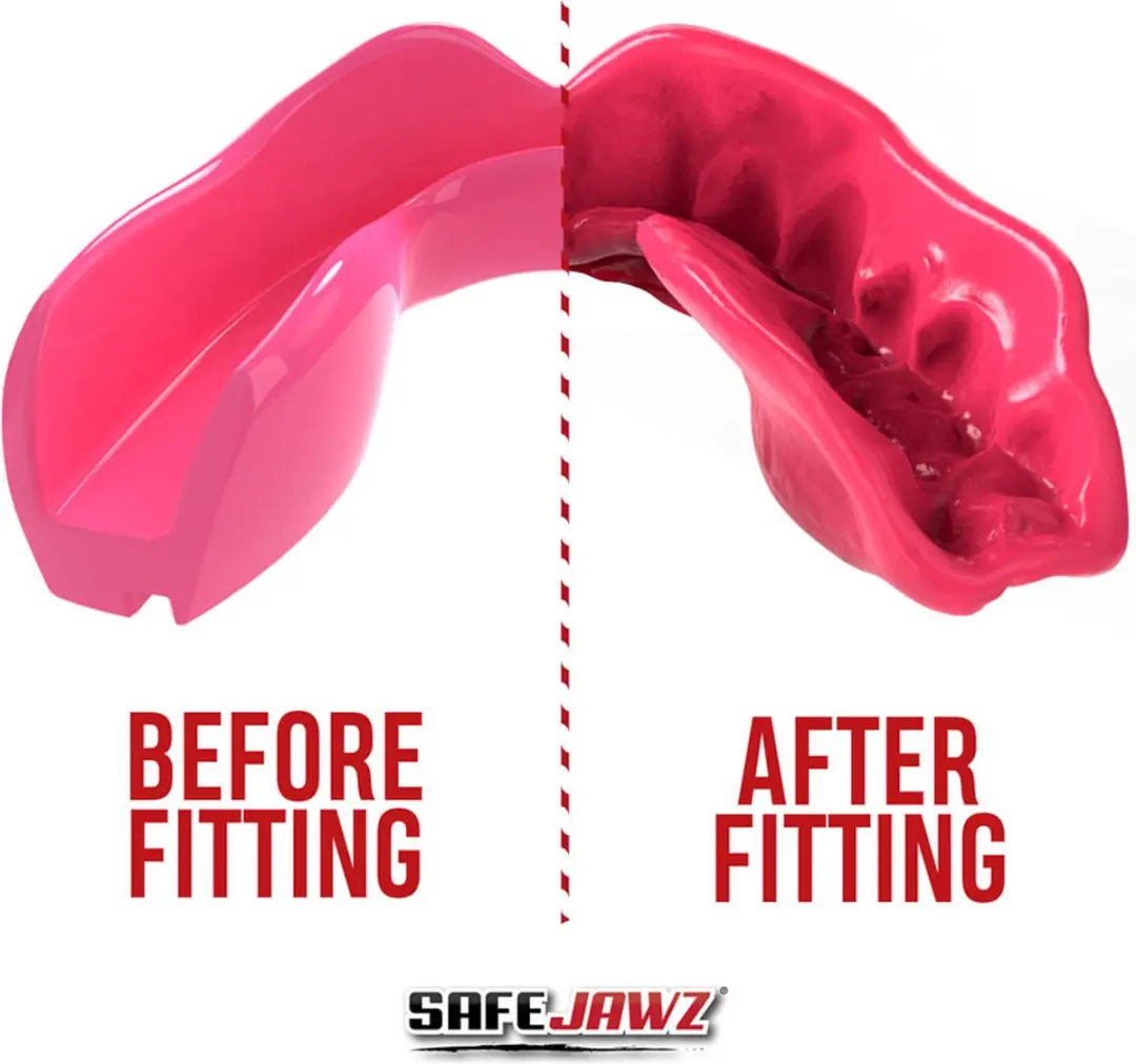 Safejawz Intro-Series Gebitsbeschermer Roze Junior