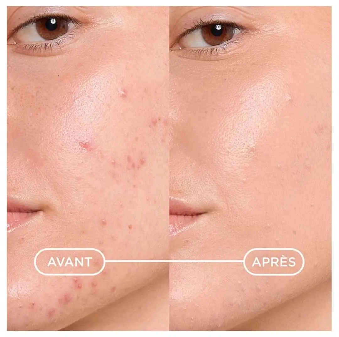Bioderma Sébium Kérato+ Cover Gekleurde Gel-Crème 30ml - Medium