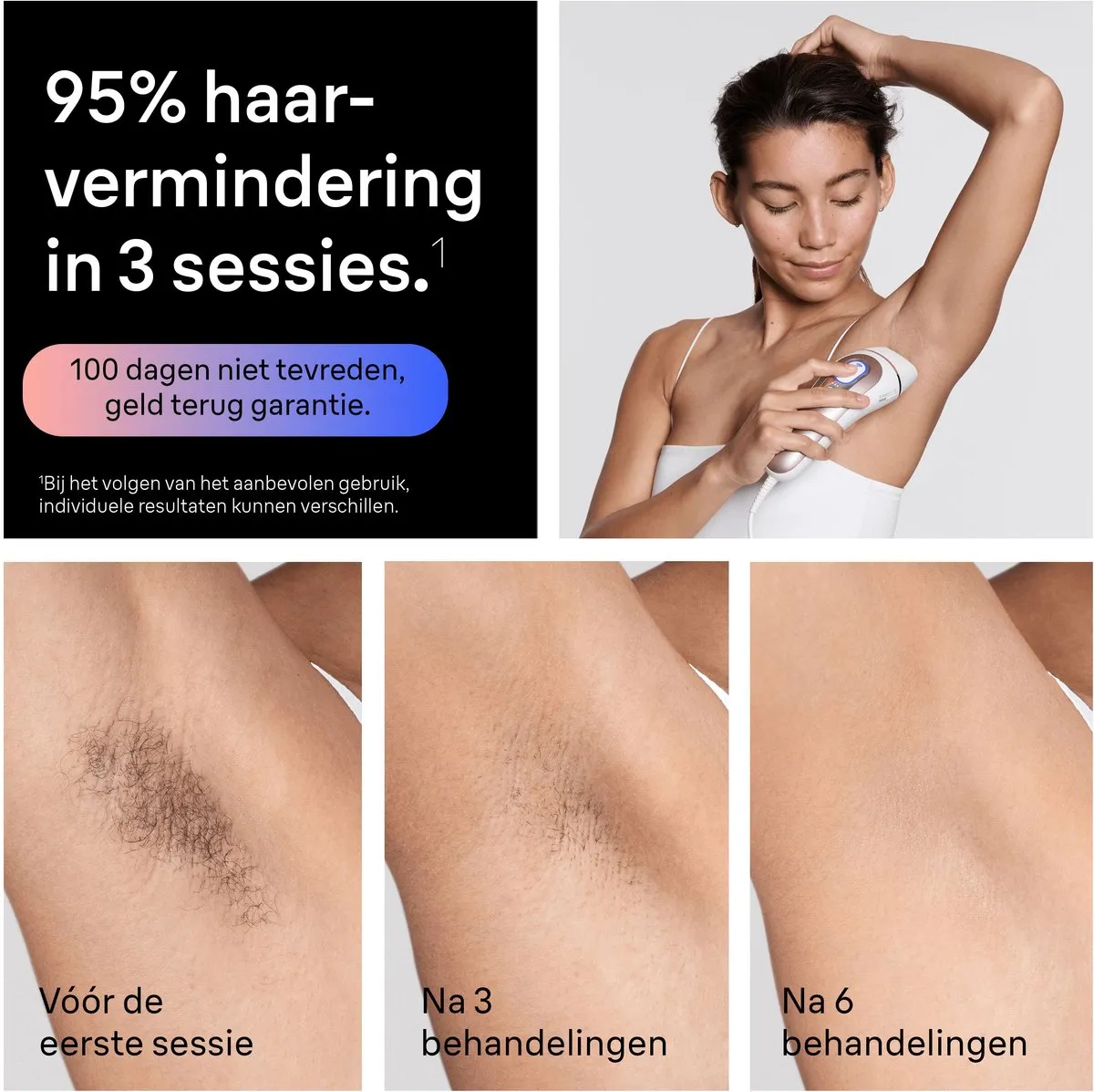 Braun Smart Skin i·expert PL7432 IPL Ontharingsapparaat - 400.000 Flitsen - Wit - afbeelding 6 van 6