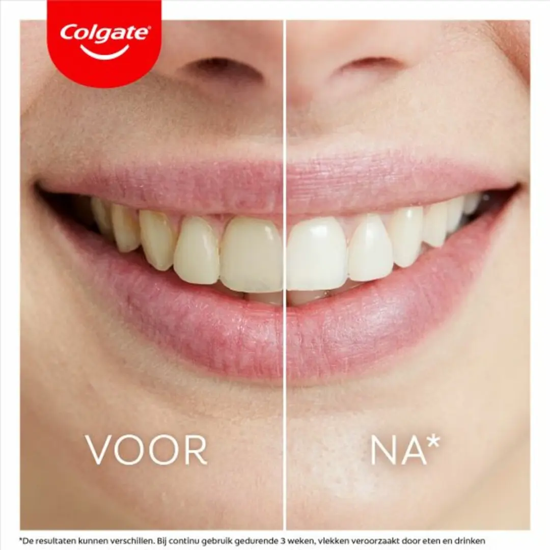 Colgate Max White Overnight Tanden Whitening Serum 2,5ml - 6 Stuks - afbeelding 6 van 6