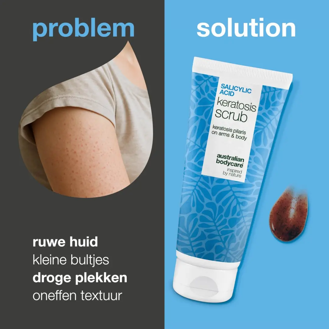 Australian Bodycare Keratosis Pilaris Body Scrub 200ml