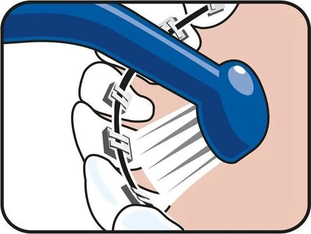 TePe Implant Care Tandenborstel - 3 Stuks