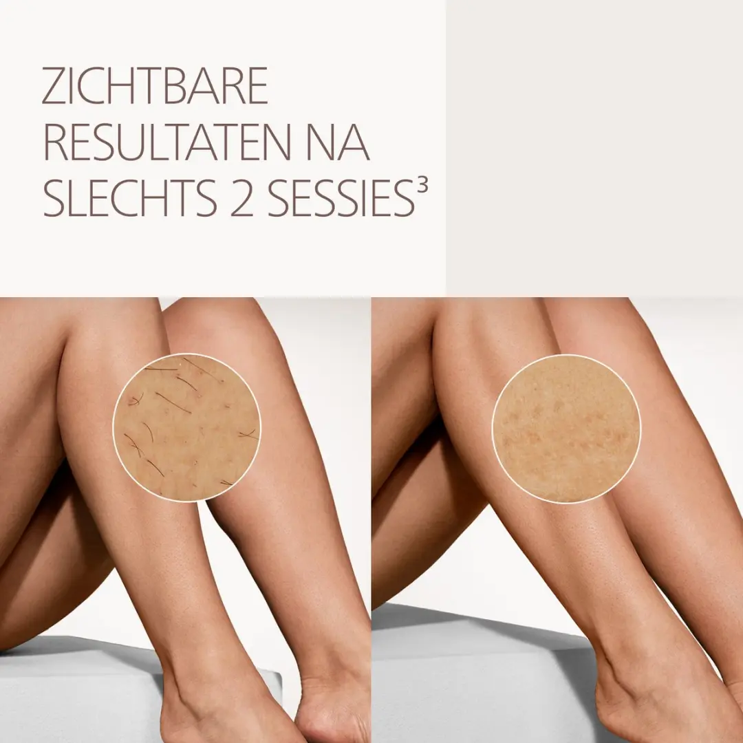 Philips Lumea 8000 Series BRI934/00 IPL Ontharingsapparaat - 450.000 Flitsen - Chic Pink