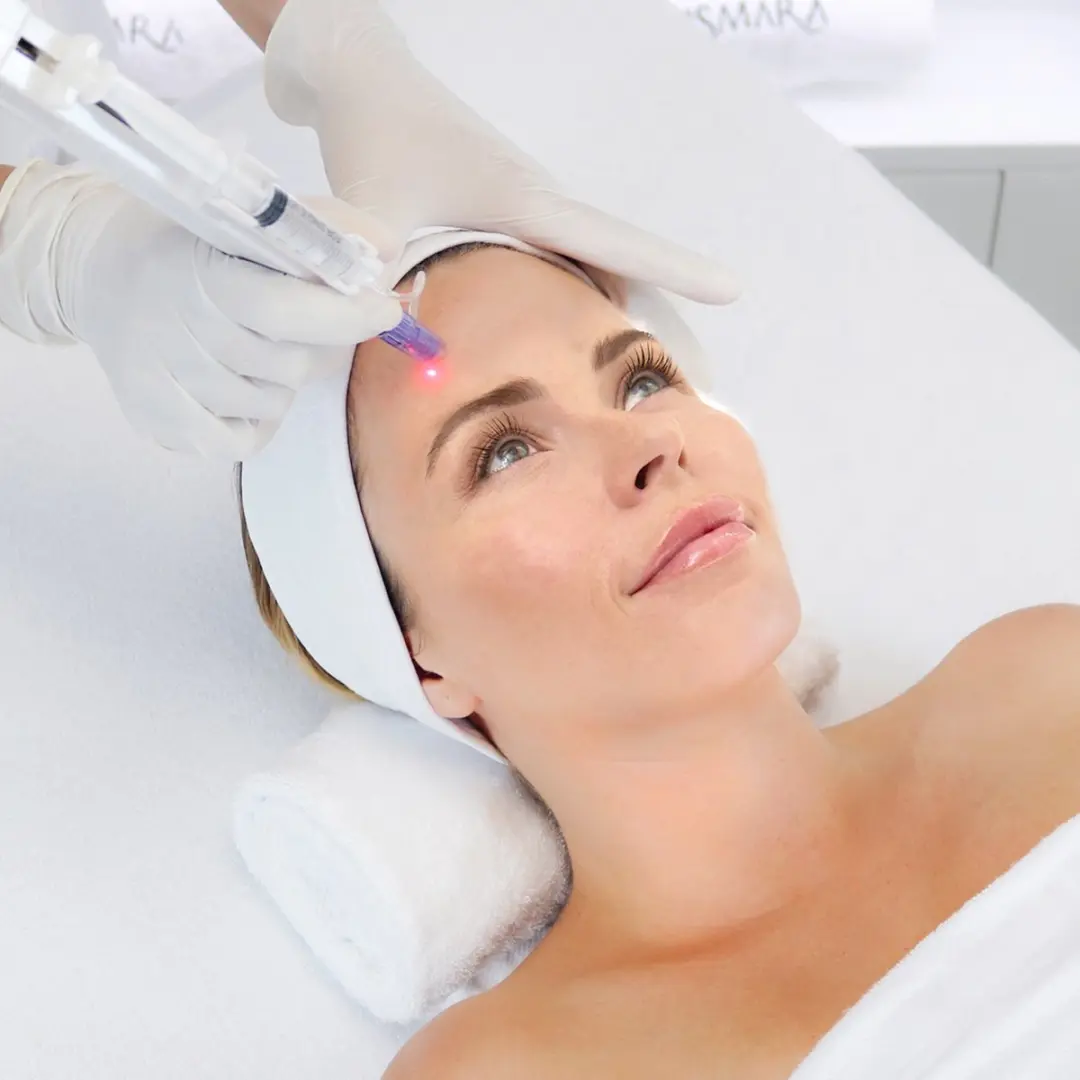Casmara Activator Pen Microneedling Systeem