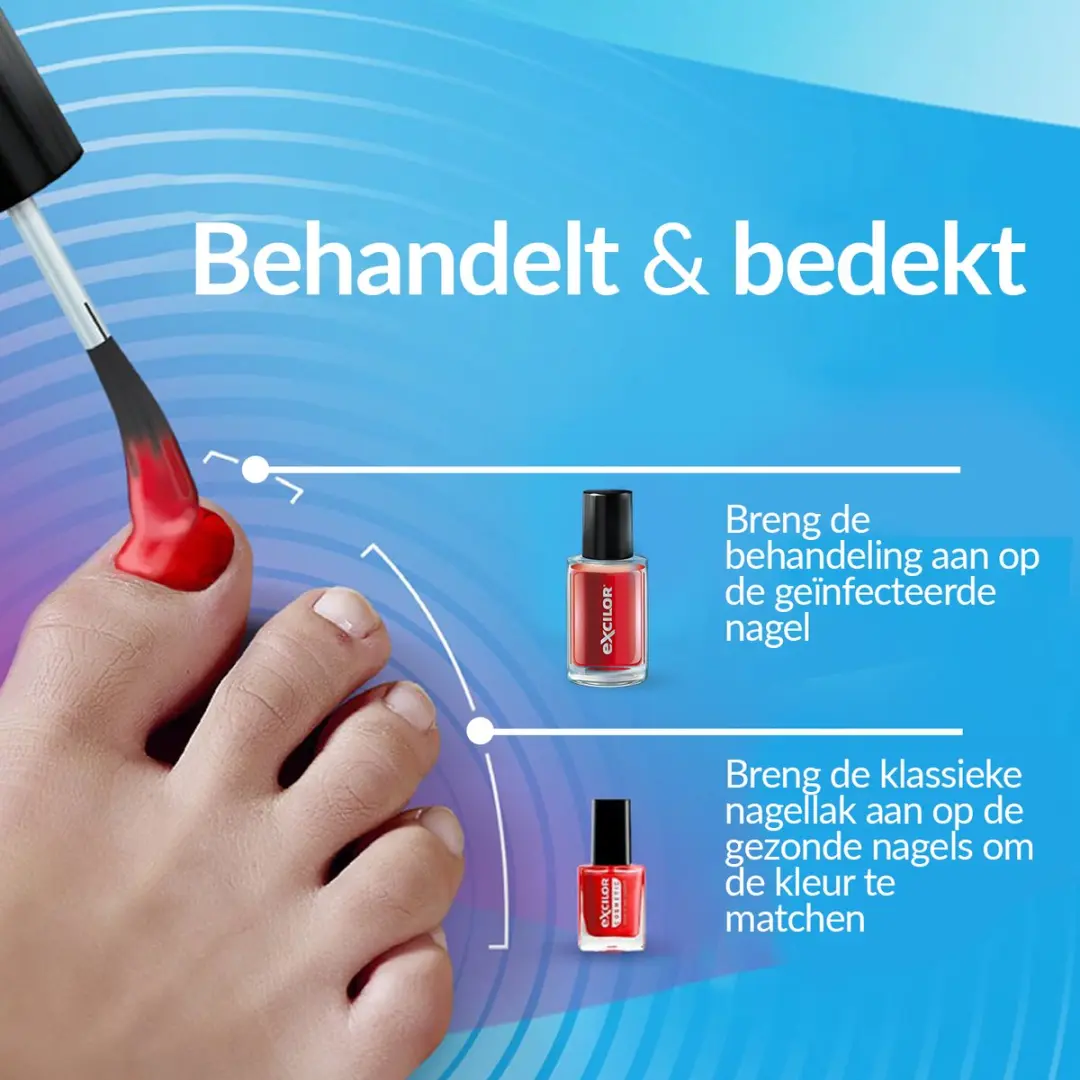 Excilor Forte Color Red Schimmelnagel 38ml - Nagellak 8ml