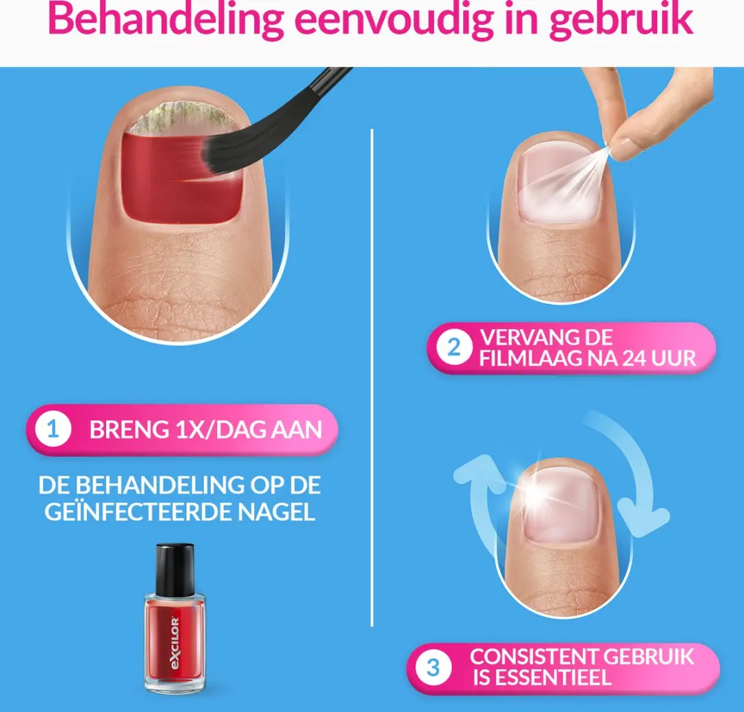 Excilor Forte Color Red Schimmelnagel 38ml - Nagellak 8ml