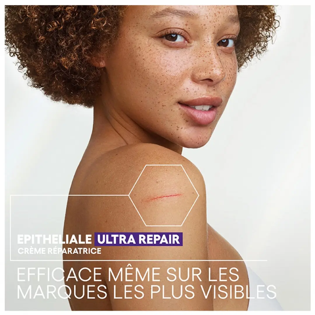 A-Derma Epitheliale A.H Ultra Repair Anti-Rimpel Crème 100ml
