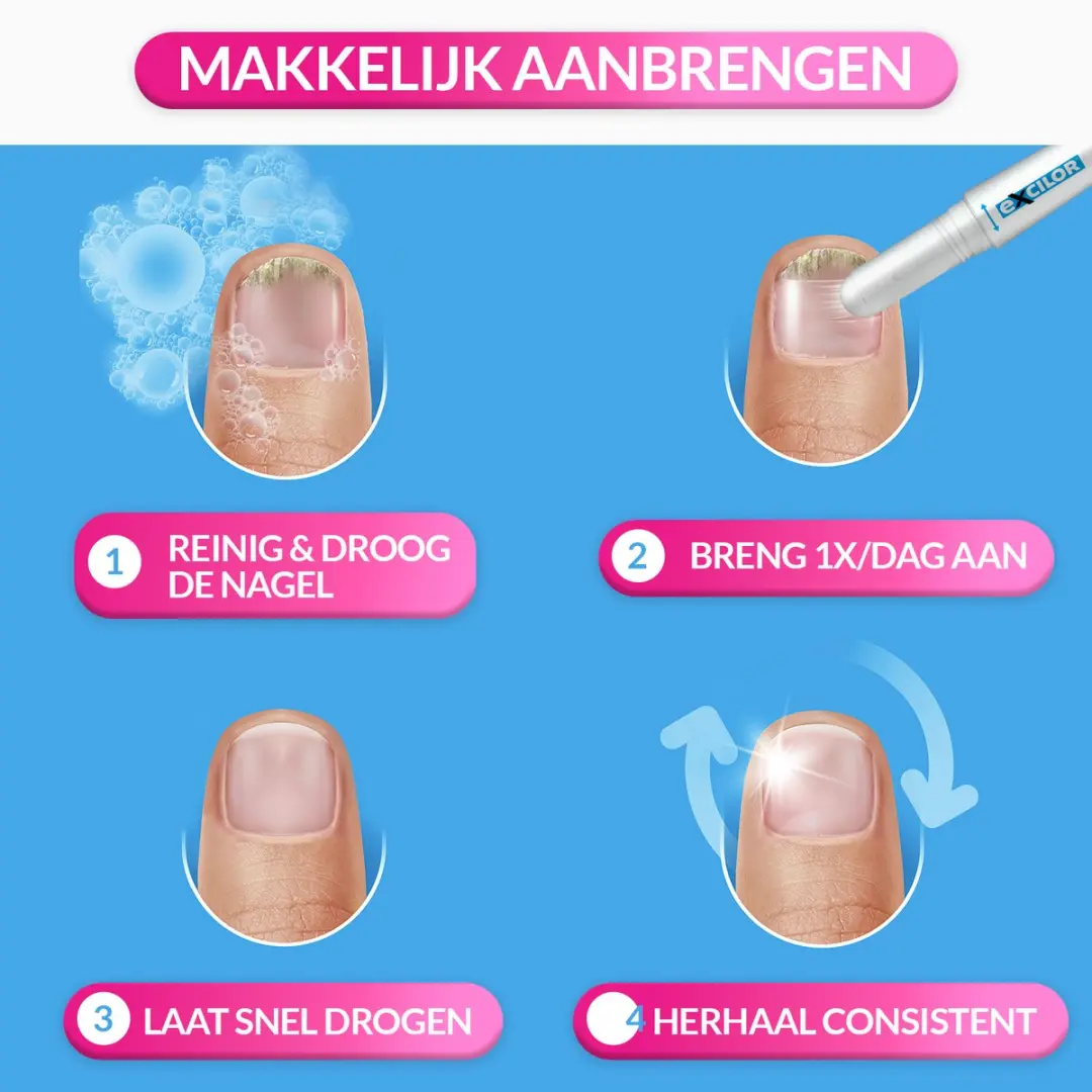 Excilor Easy Pen Nagelbehandeling Schimmelnagels 4ml