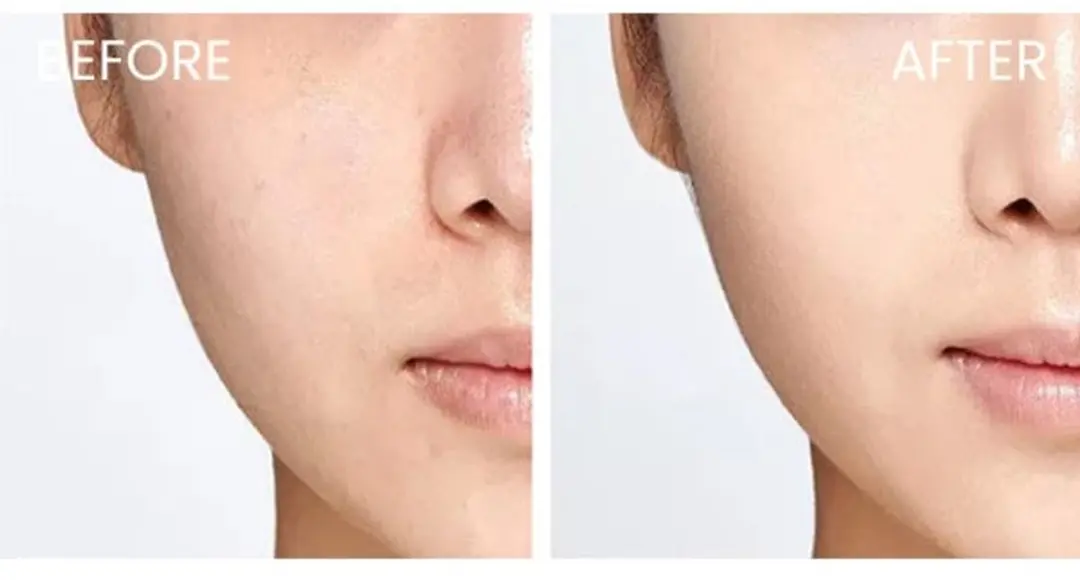 Skin1004 Madagascar Centella Travel Kit - 5 Stuks