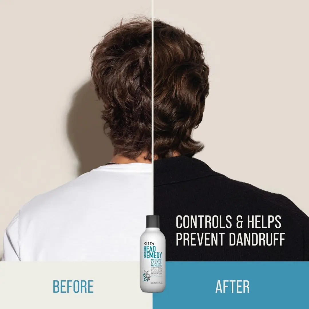 KMS Hair Head Remedy Anti-Dandruff Shampoo 300ml