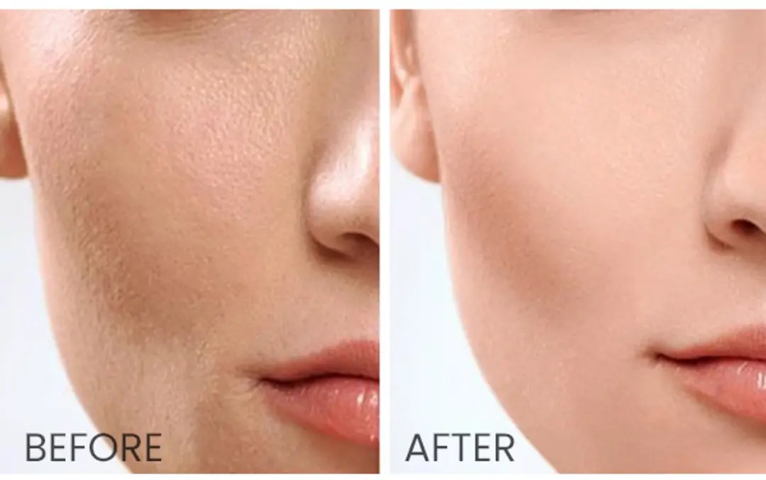 Skin1004 Madagascar Centella Toning Toner 210ml - afbeelding 6 van 6