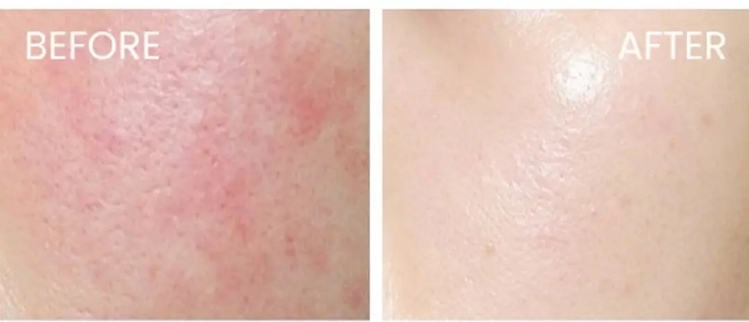 Skin1004 Madagascar Centella Tea-Trica B5 Cream 75ml