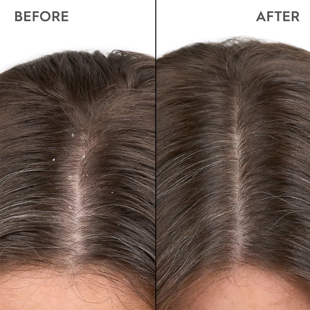 Kerasilk Anti-Dandruff Scalp Serum 100ml