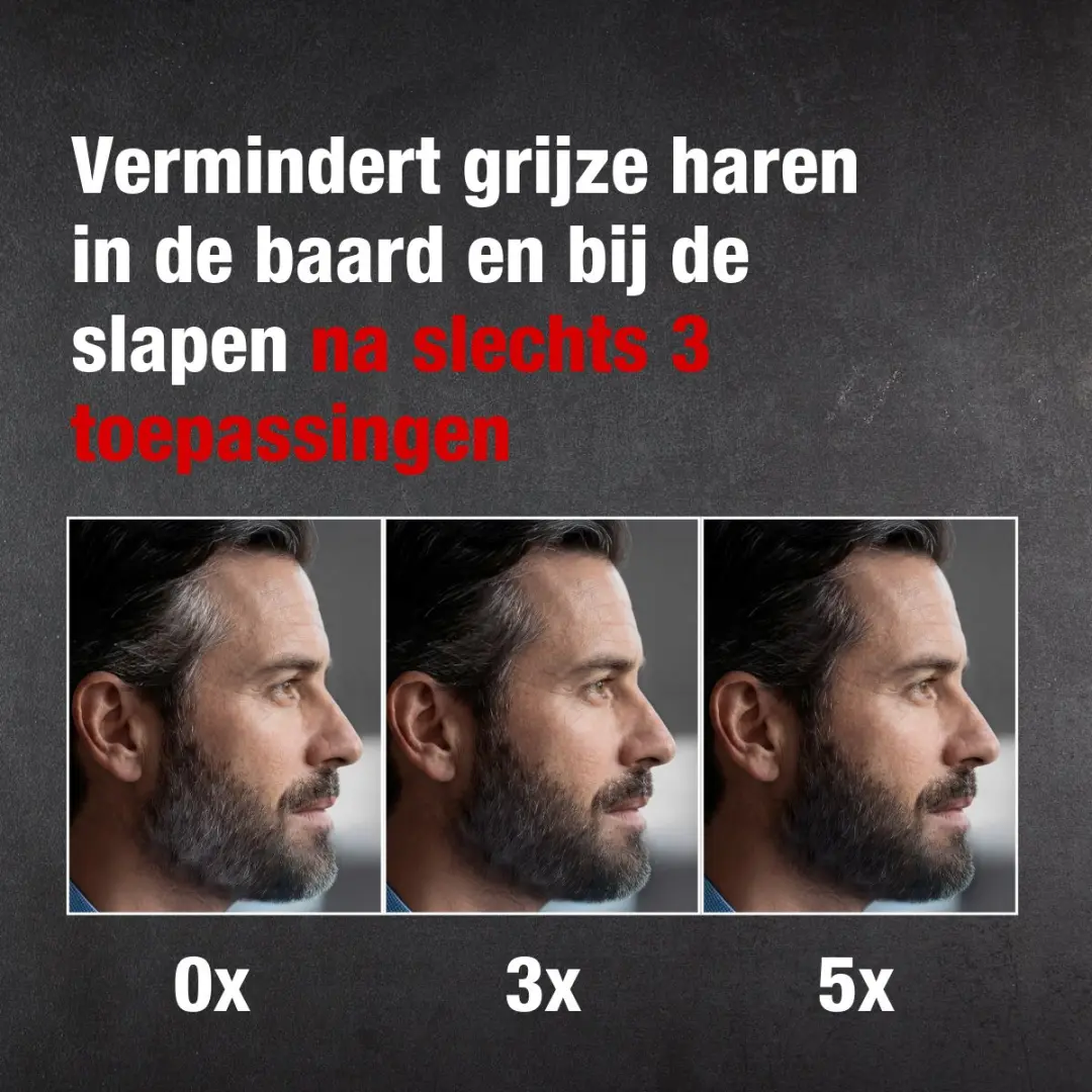 Alpecin Grey Attack Beard & Temples Kleur Booster 250ml - 2 Stuks