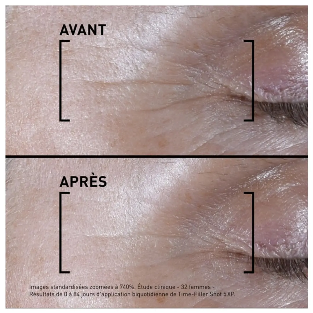 Filorga Time Filler Shot 5XP Serum 15ml