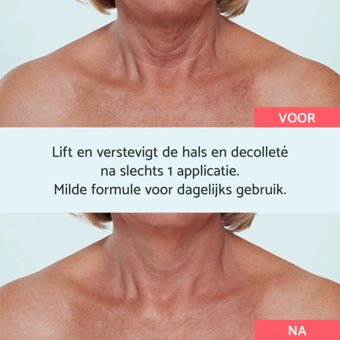 Remescar Hals & Decolleté Anti-Aging Crème 40ml