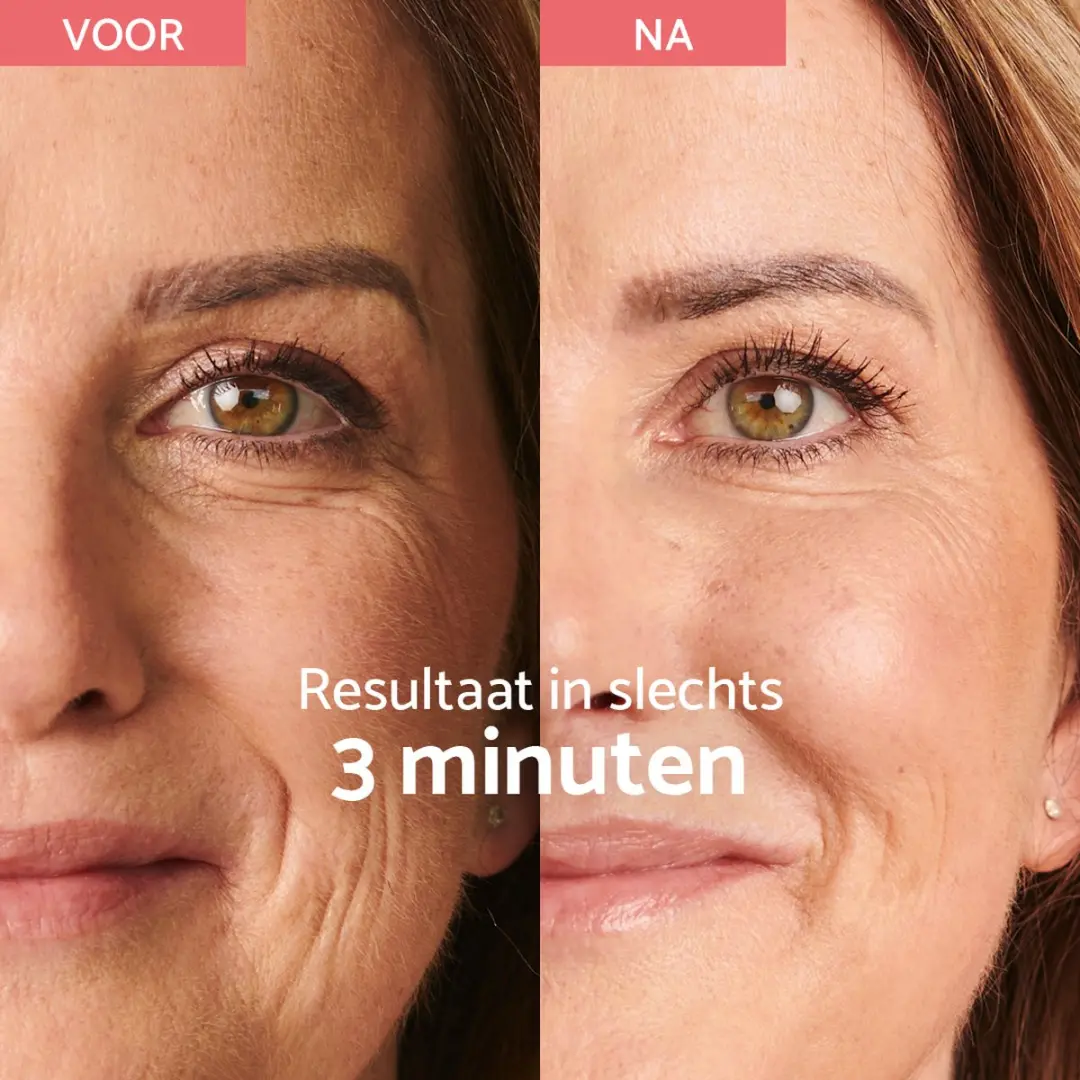 Remescar Instant Rimpel Corrector 8ml