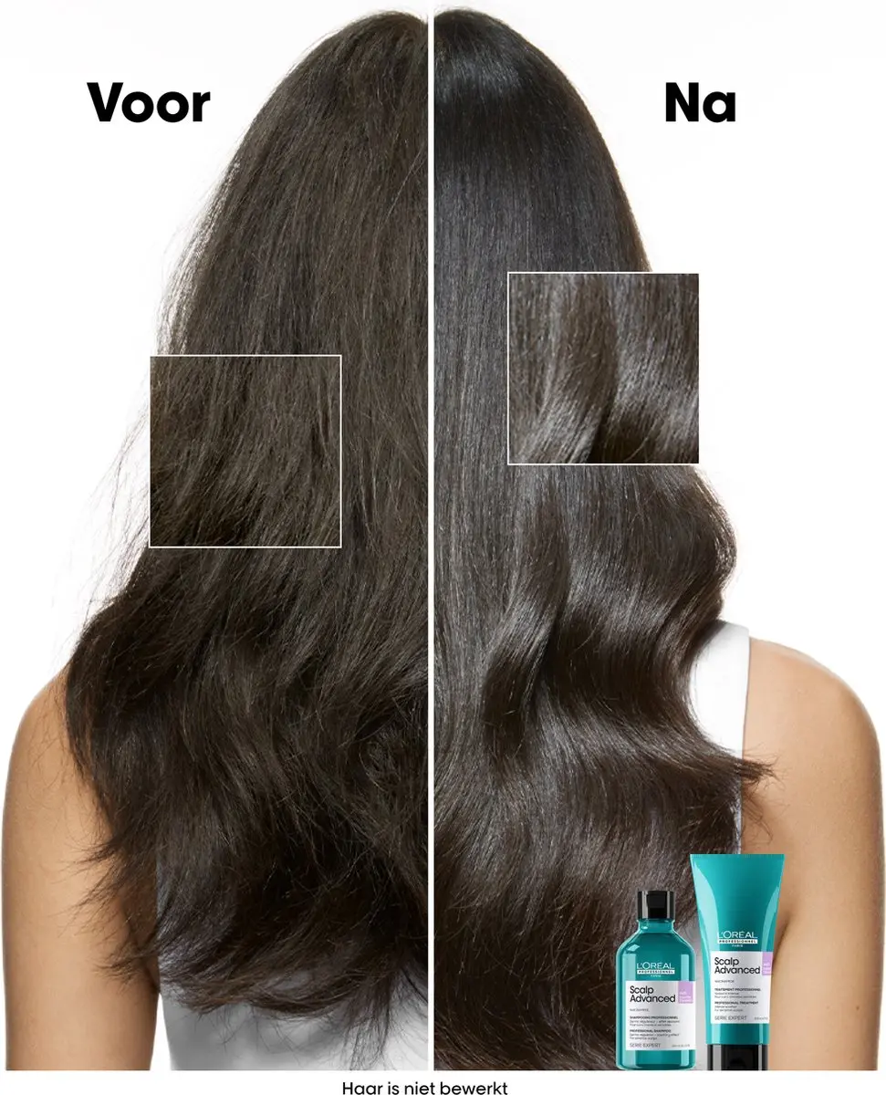 L'Oréal Professionnel Scalp Advanced Shampoo Anti-Discomfort 500ml - afbeelding 6 van 6