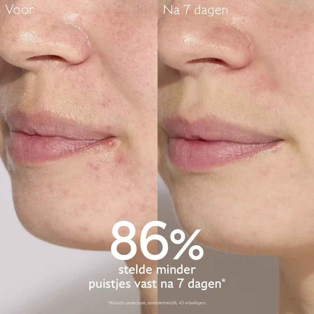 Caudalie Vinopure Serum 30ml