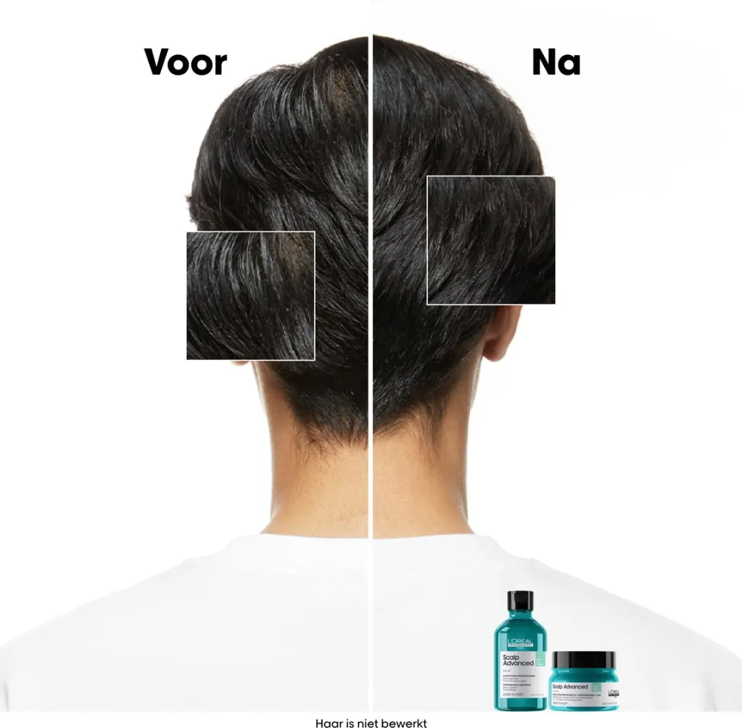 L'Oréal Professionnel Scalp Advanced Shampoo Anti-Oiliness 500ml