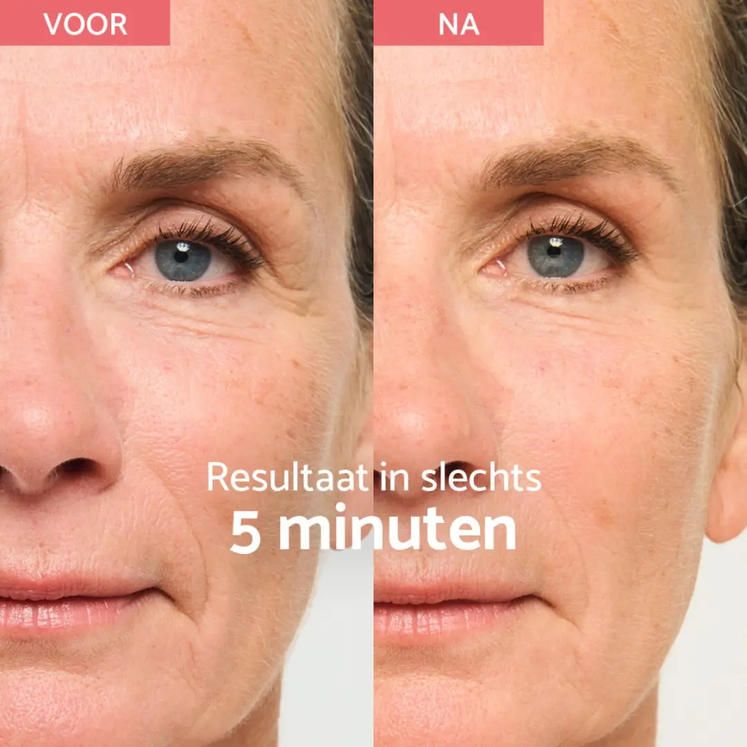 Remescar Instant Facelift Crème 40ml