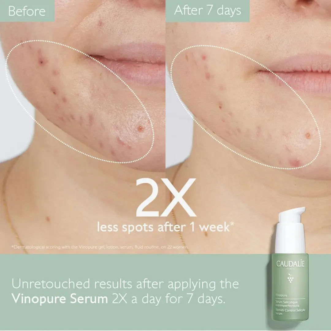 Caudalie Vinopure Serum 30ml