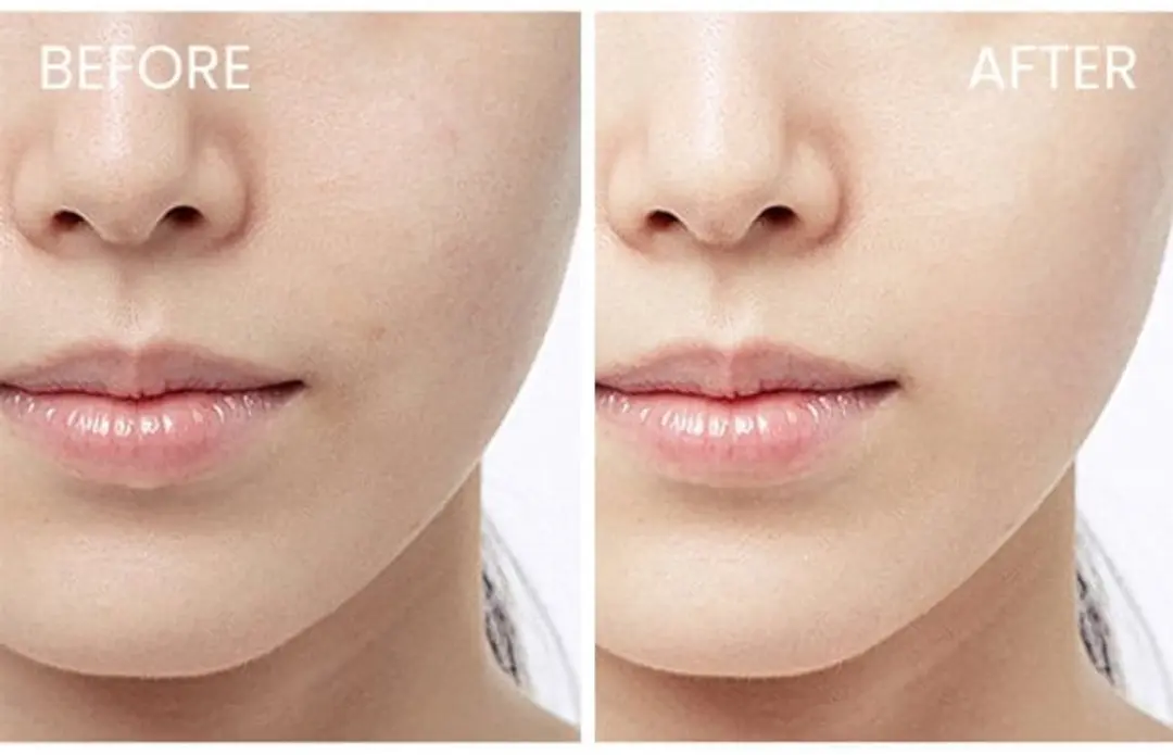Skin1004 Madagascar Centella Hyalu-Cica Cloudy Mist 120ml
