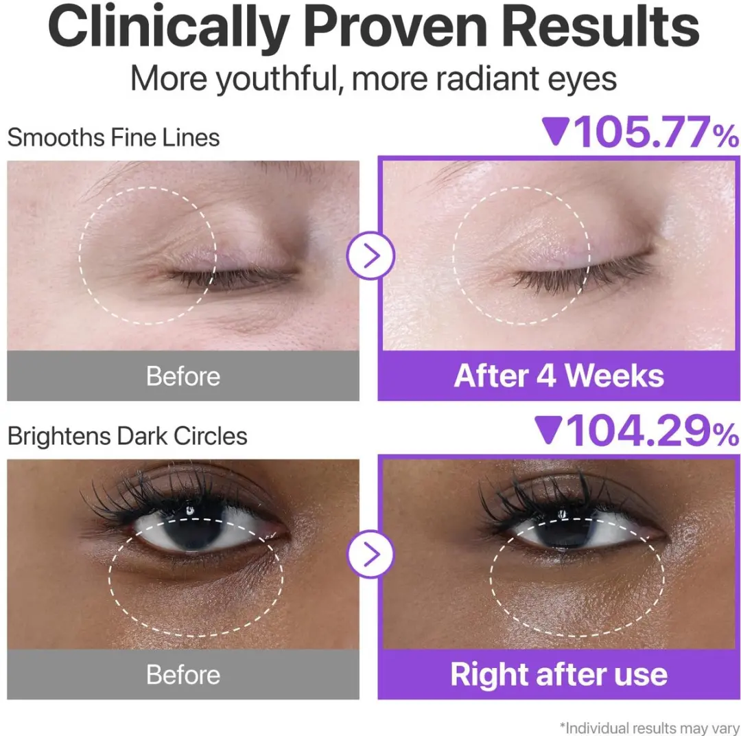 Numbuzin No.9 NAD+ VolumeTox Retinol Oogcrème 10ml