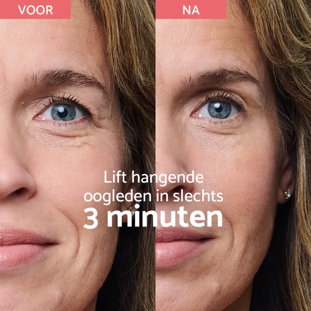Remescar Tensor Anti-Aging Oogcrème 8ml - 160x