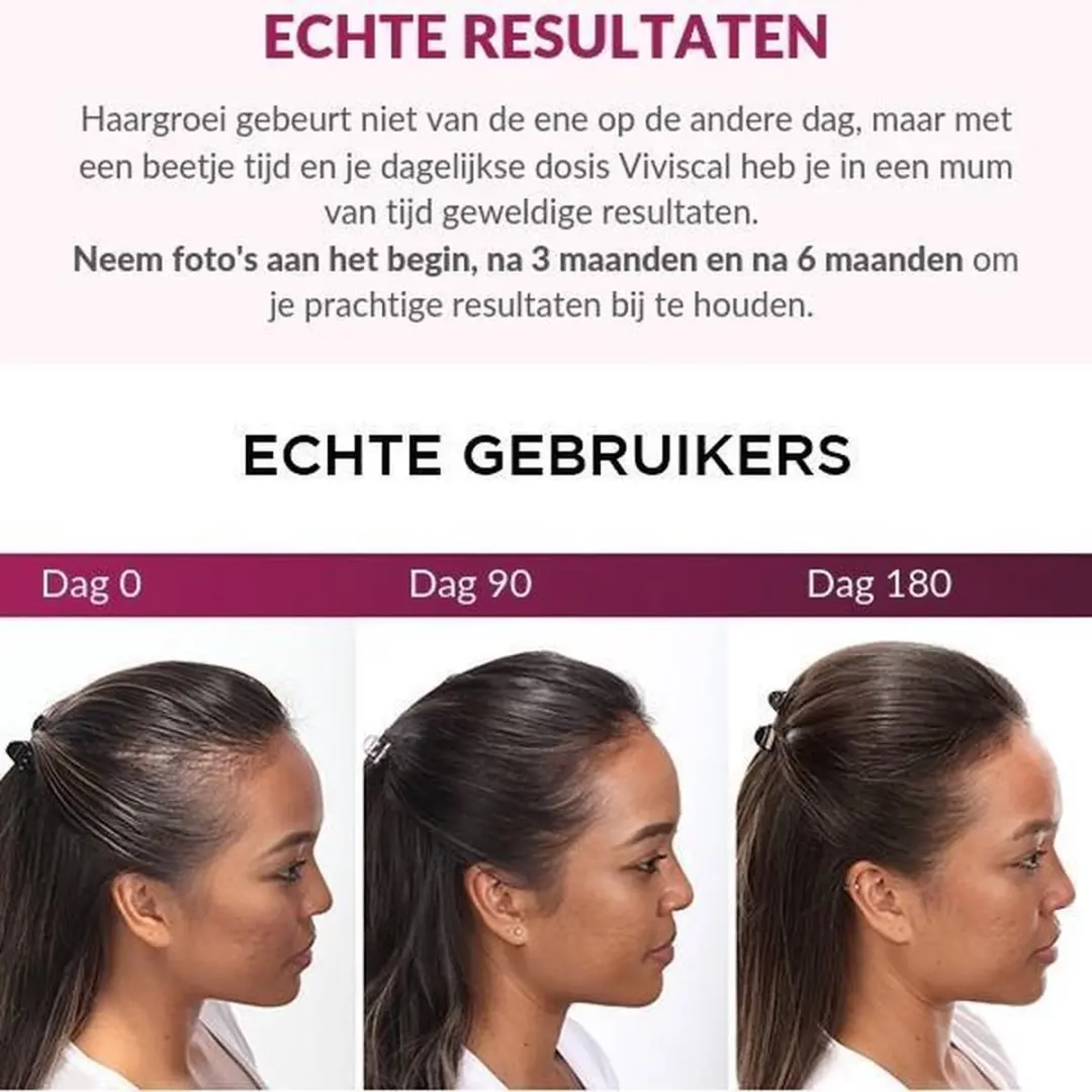 Viviscal Vrouw Haargroei Supplement 180 Stuks