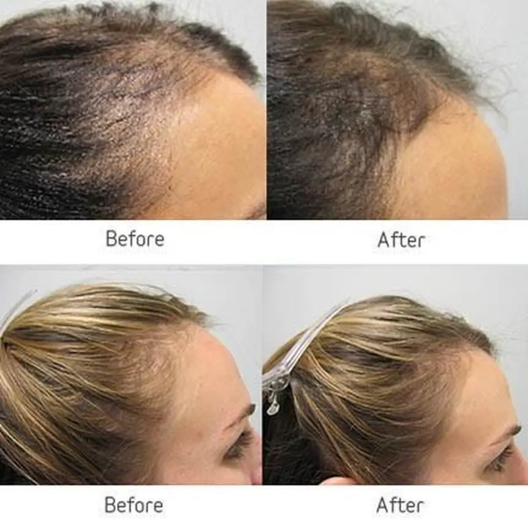 Viviscal Vrouw Haargroei Supplement 180 Stuks