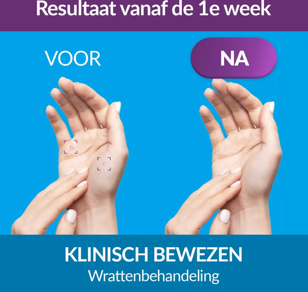 Excilor Gelbehandeling Wratten 4ml - Voor Handen & Voeten