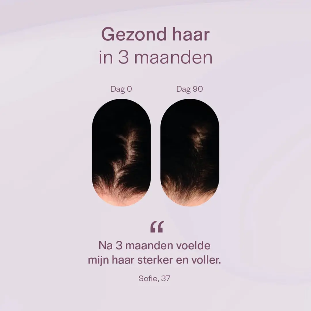 Belène Hair Pro Haar Supplement 180 Capsules