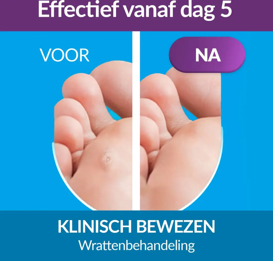 Excilor Wrattenbehandeling Duo Power - 10ml