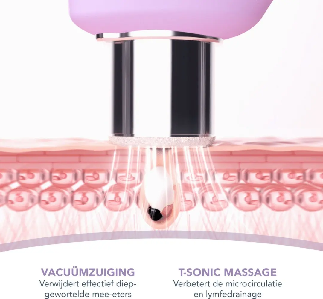 FOREO KIWI Derma Microdermabrasie 2 Stuks - 100g
