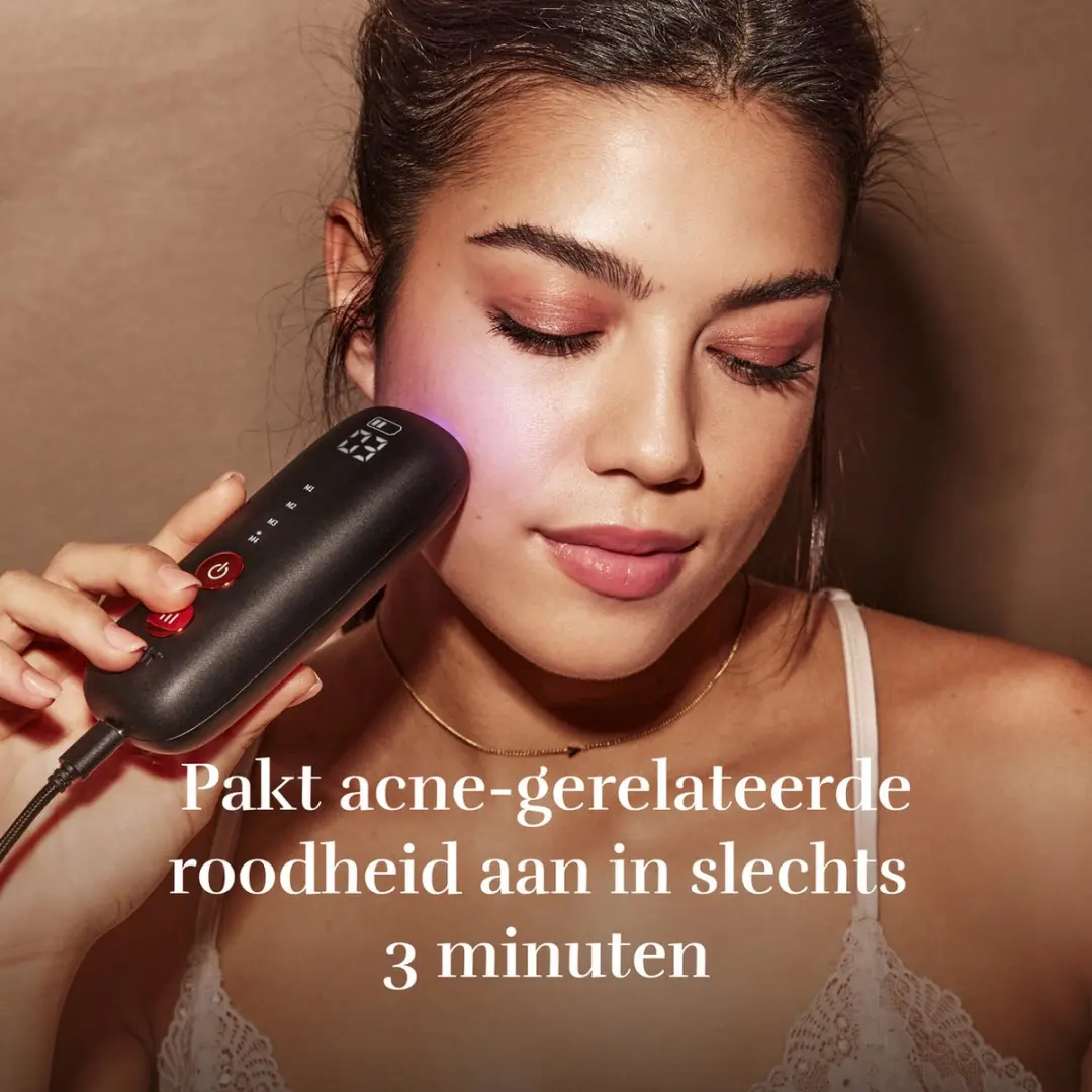 Silk'n LED Gezichtsmasker FNLM2PEU001 - Huidverjonging - Zwart