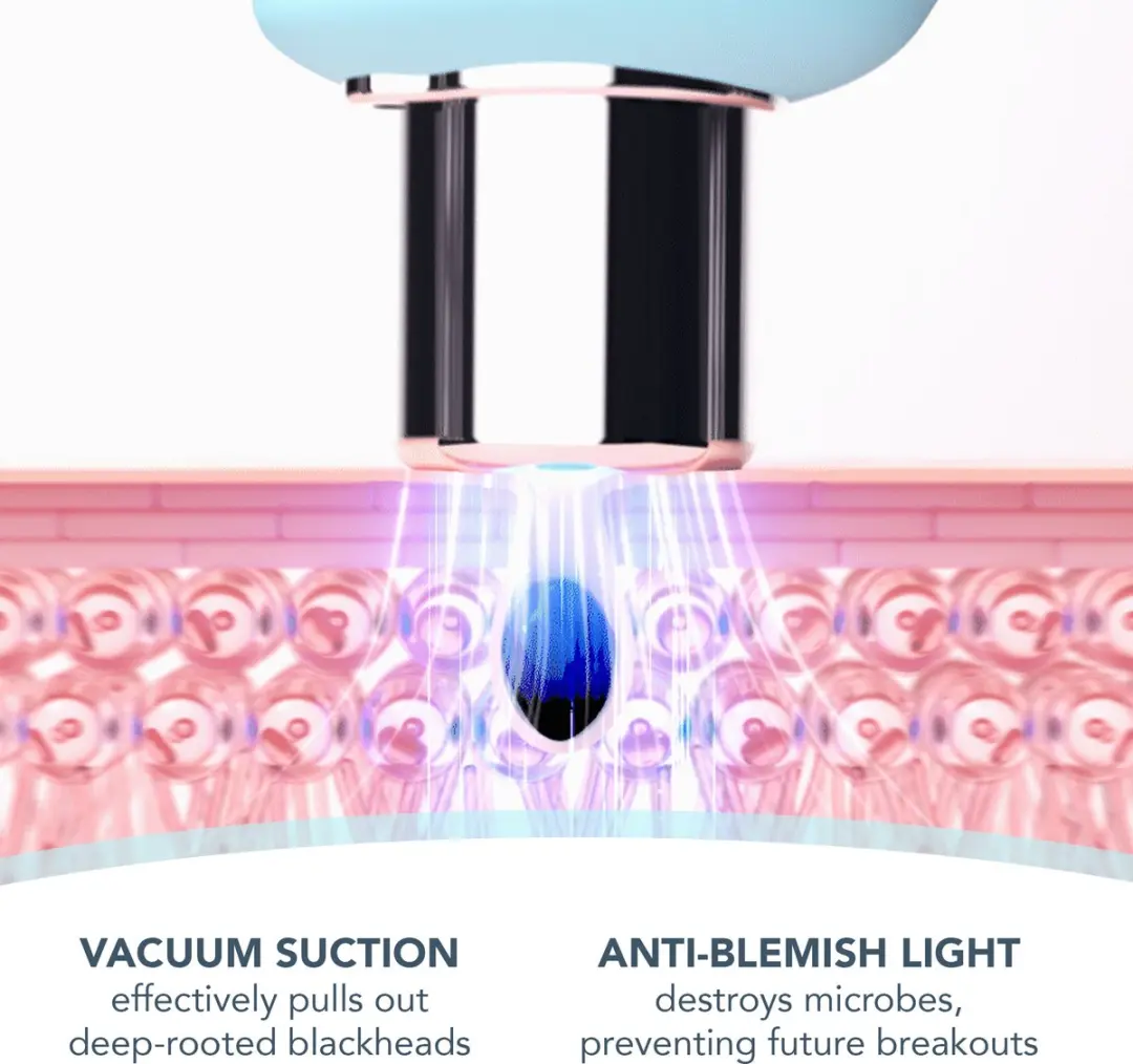 FOREO Blackheads Suck KIWI F2174 Vacuüm huidverzorgingsset - 6 snelheden - Aqua/Zilver