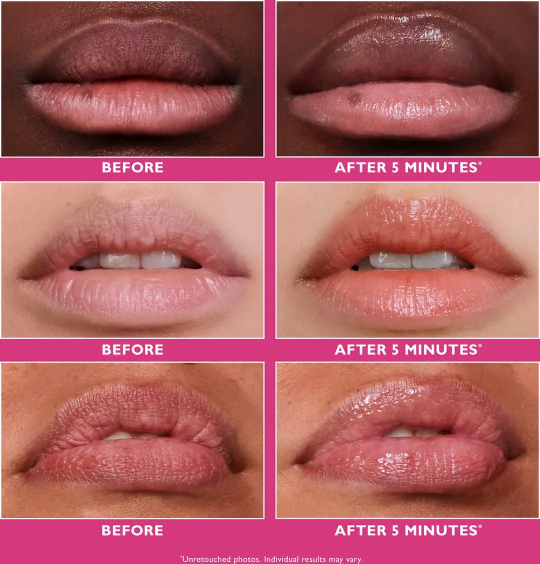 Peter Thomas Roth Instant FIRMx Lipserum 10ml