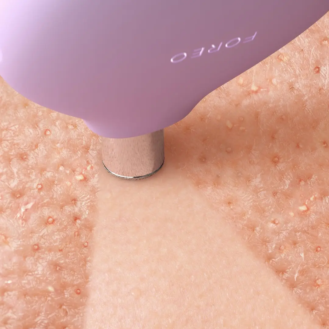 FOREO KIWI Derma F1955 Diamant Microdermabrasie - 6 Snelheden - Lavender