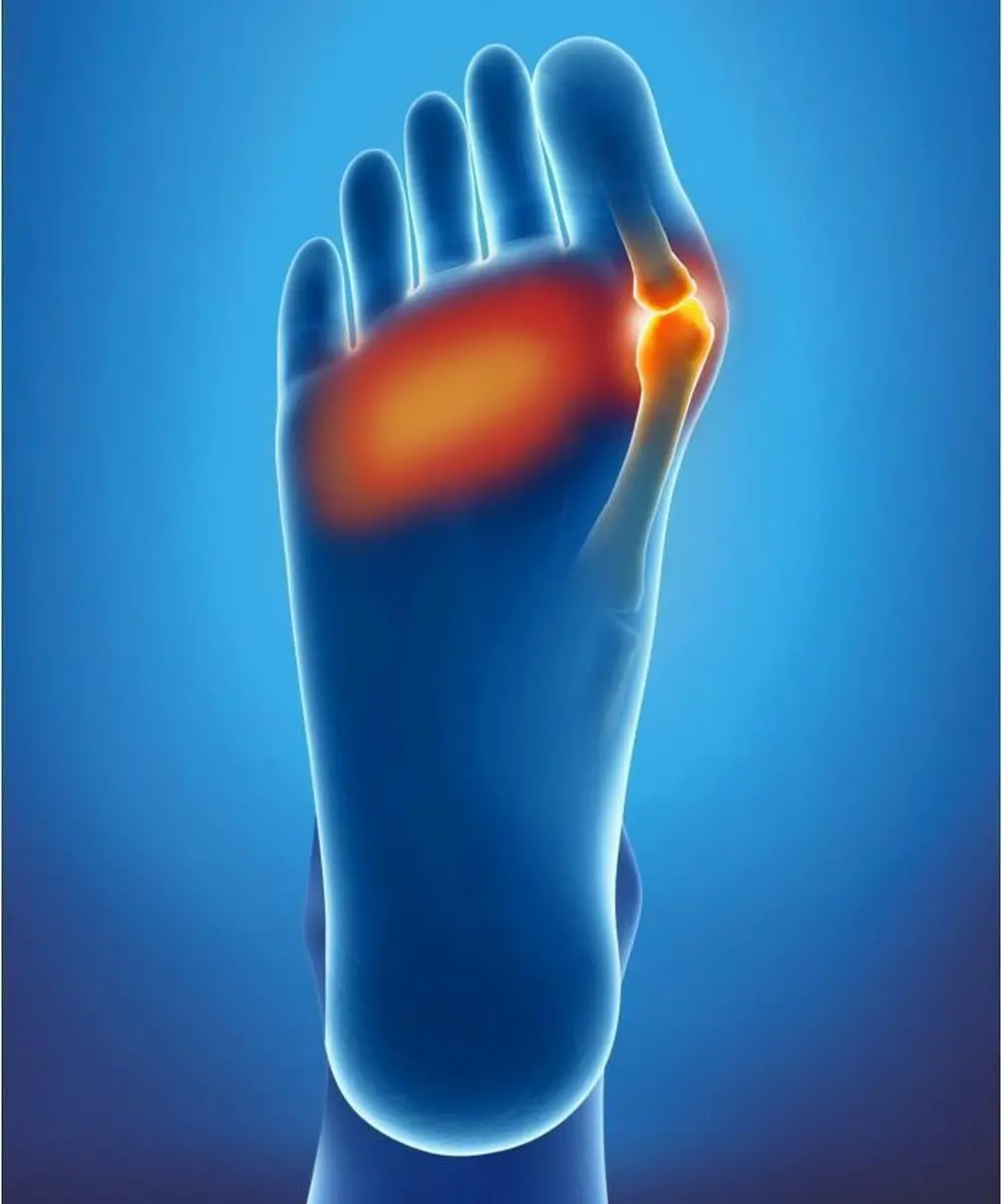 Epitact Dubbel Corrigerende Orthese Hallux Valgus Links M