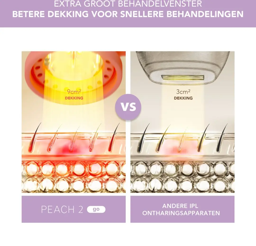 FOREO Peach 2 Go IPL Ontharingstool - 500.000 Flitsen - Goud/Paars/Rozig