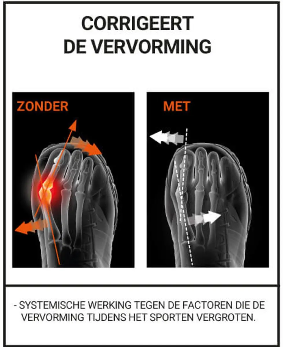 Epitact Sport Hallux Valgus Brace - Zwart