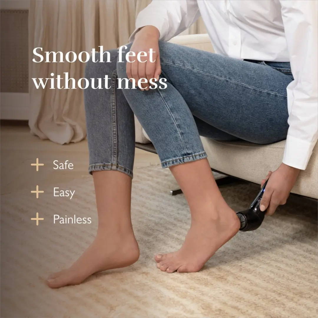 Silk'n FreshPedi Elektrische Eeltverwijderaar FP1PE1Z001 - 2 Snelheden - Zwart